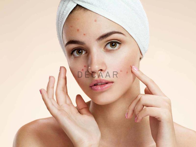 skincare cho da dầu mụn